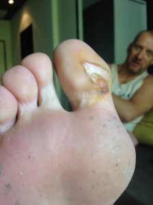 Wonder how my toe is after the training? 